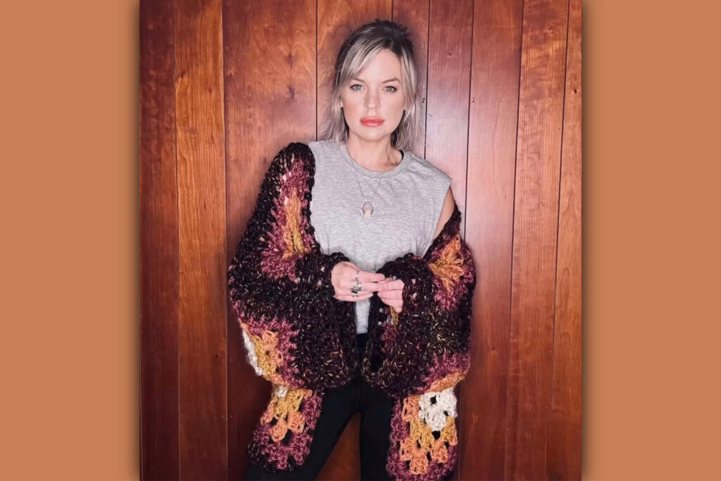 Kirsten Storms treated for brain aneurysm 